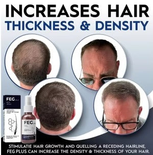 FEG PLUS Hair Growth Spray 50ml | Habibi Buy